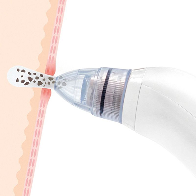 PORE-OFF : Nettoyeur Électrique pour Visage