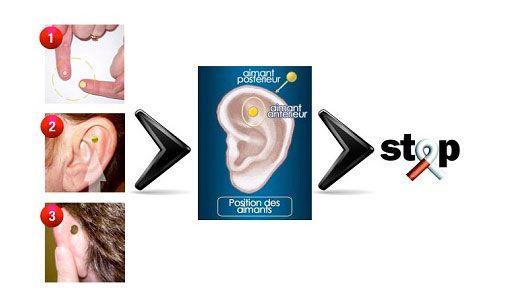 Aimants Auriculaires Anti-Tabac pour Arrêter de Fumer par Auriculothérapie Groupon Lot pour Loto